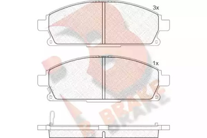 Комплект тормозных колодок (R BRAKE: RB1521-200)