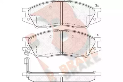 Комплект тормозных колодок (R BRAKE: RB1635)