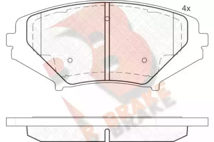 Комплект тормозных колодок (R BRAKE: RB1670)