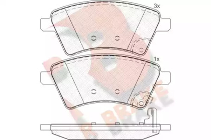 Комплект тормозных колодок (R BRAKE: RB1758)